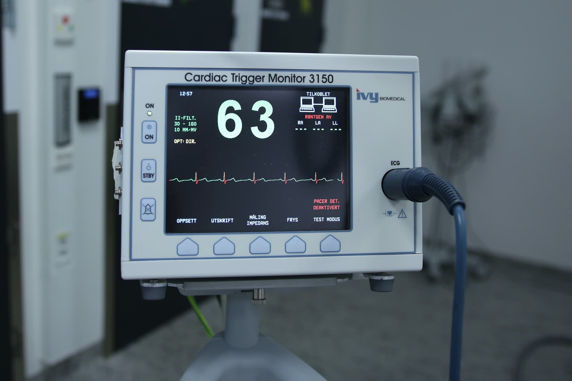 Cardiac trigger monitor