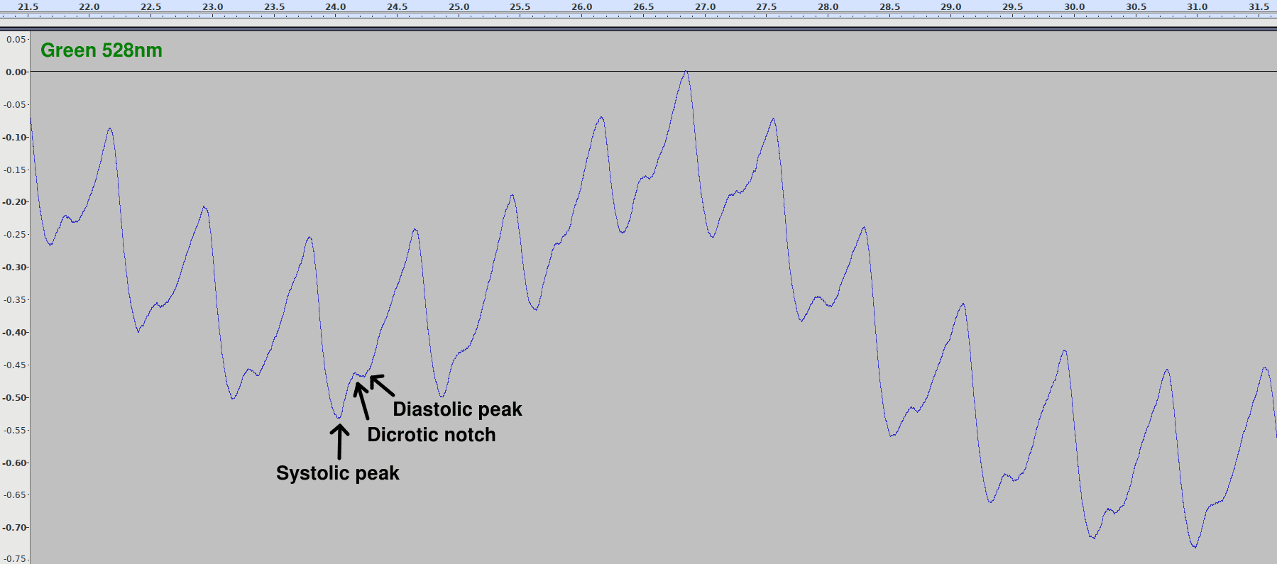 Image showing clear pulse with diastolic